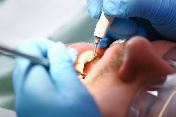 Best Pediatric Emergency Dentist in San Bernardino, CA