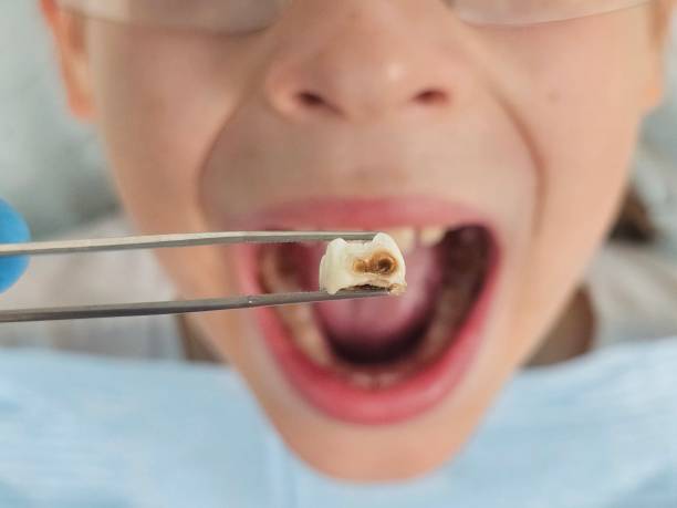 Best Walk-In Emergency Dentist in San Bernardino, CA